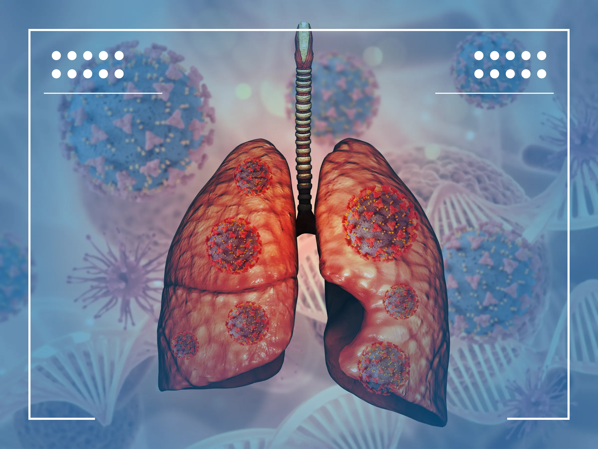 Adenocarcinoma metastático